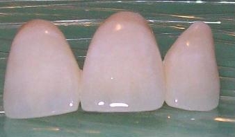 Zirconia