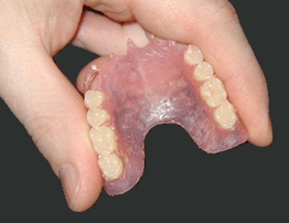 protesi flessibile nylon